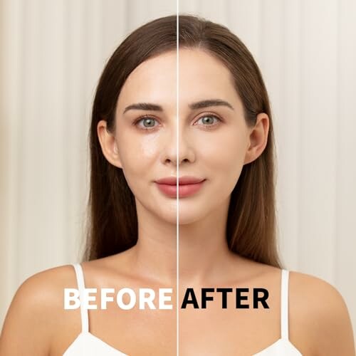 Before and after skincare comparison on woman's face.