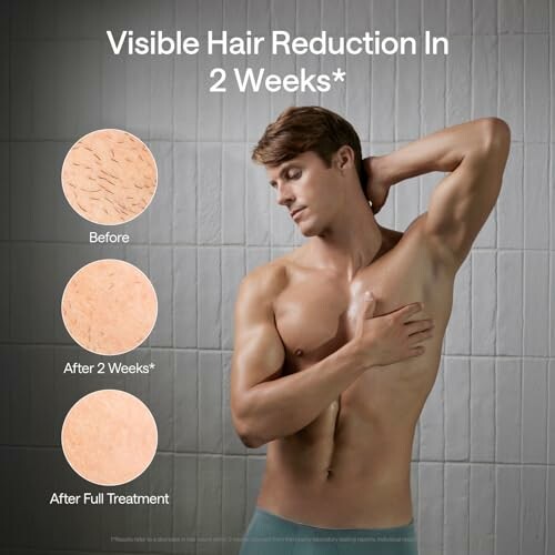 Before and after hair reduction results on a man's underarm.