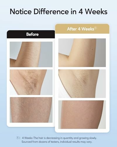 Comparison of hair reduction on skin before and after 4 weeks.