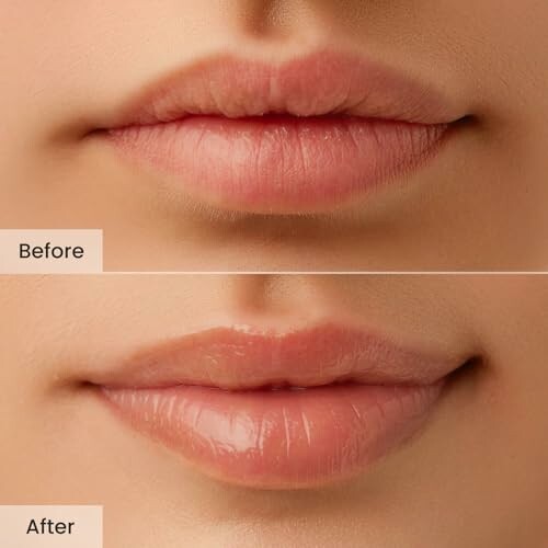 Close-up of lips showing before and after enhancement.