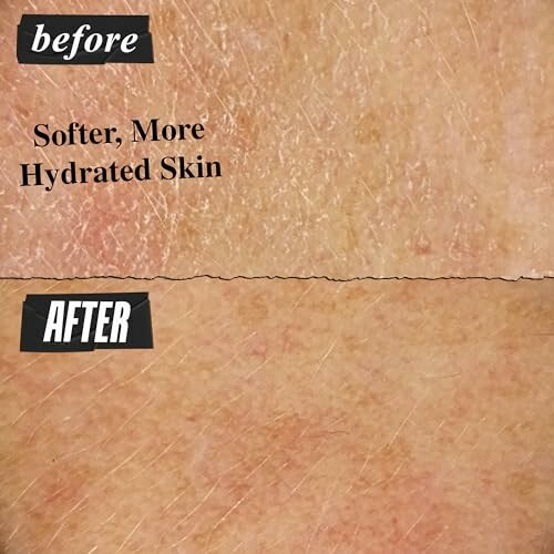 Before and after comparison of skin showing hydration improvement.