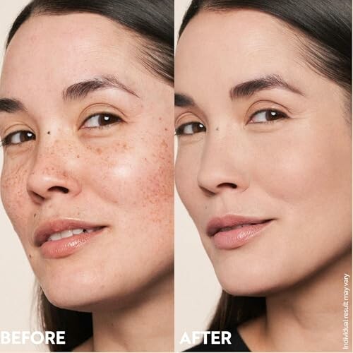 Side-by-side comparison of a woman's face showing results before and after skincare treatment.