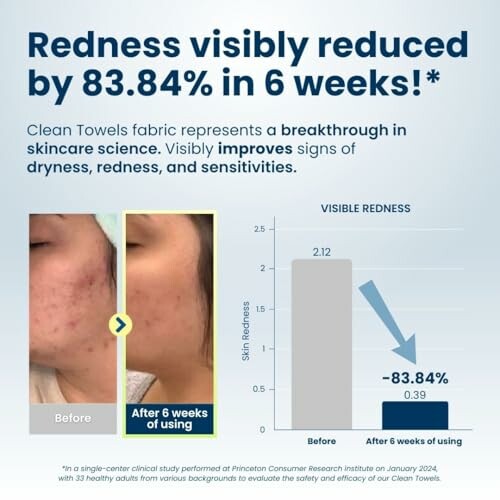 Before and after comparison showing reduced redness in skin after 6 weeks.