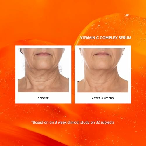 Before and after comparison of skin with Vitamin C Complex Serum